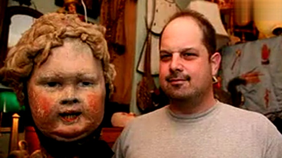 �ֲ��ӻ�����Ӥ��ͷ��